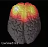thumbnail: brain.png